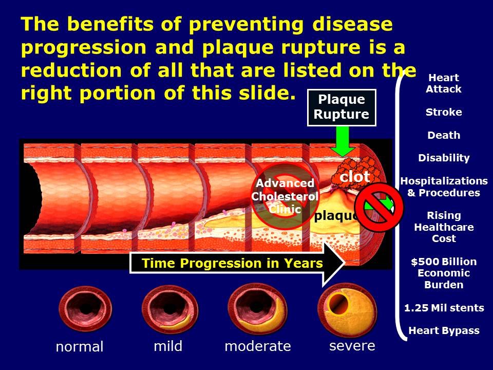 Benefits of Preventive Treatment