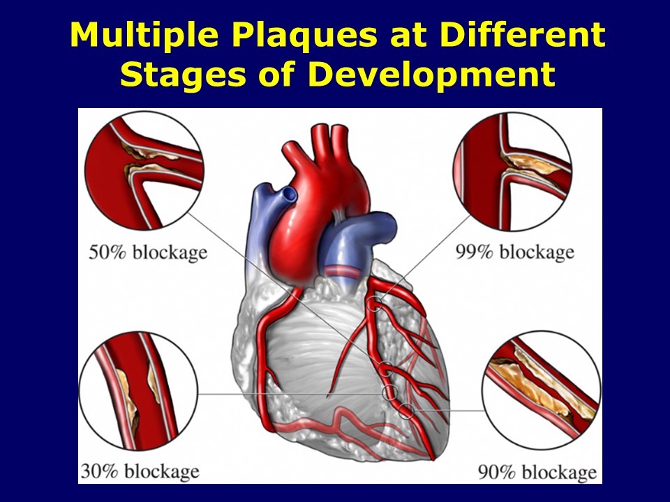 Multiple Plaques at Different Stages of Development