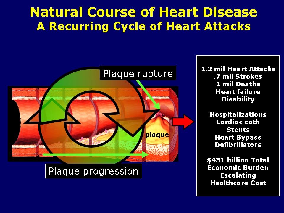 Without Prevention - Increasing Revenues